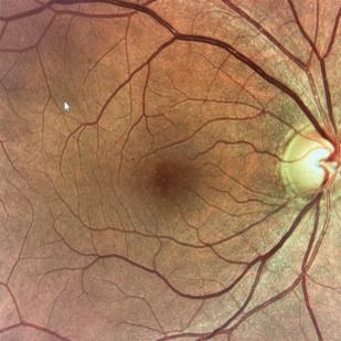 OBRA 10_MONTEAUDIO23_LUISMARISQUIRENA.jpg